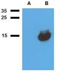 Anti-Mycobacterium tuberculosis Acr1 antibody [PAb (185)] used in Western Blot (WB). GTX00500