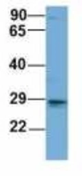 Anti-EIF4E2 antibody used in Western Blot (WB). GTX00636