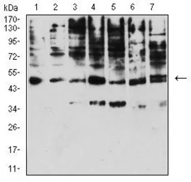 Anti-KIR3DL1 antibody [6D9A4] used in Western Blot (WB). GTX00648