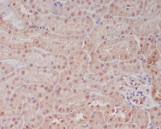 Anti-PELP1 antibody [COD-16] used in IHC (Paraffin sections) (IHC-P). GTX00668