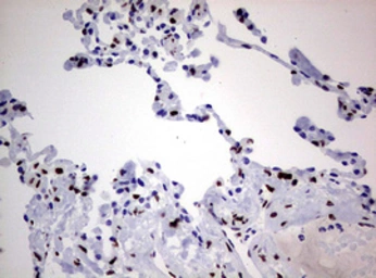 Anti-ZEB2 antibody [OTI1E12] used in IHC (Paraffin sections) (IHC-P). GTX00672