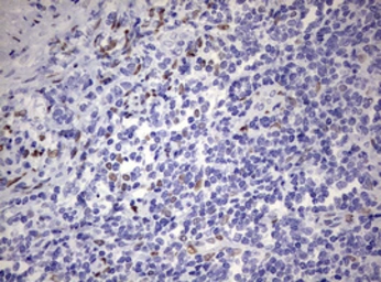 Anti-ZEB2 antibody [OTI1E12] used in IHC (Paraffin sections) (IHC-P). GTX00672