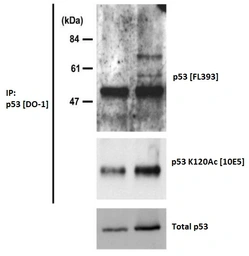 Anti-p53 (Acetyl Lys120) antibody [10E5] used in Western Blot (WB). GTX00675