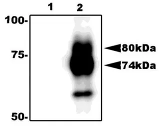 Anti-Herpes virus 6 gQ1 antibody [119] used in Immunoprecipitation (IP). GTX00685