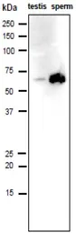 Anti-IZUMO1 antibody [#125] used in Western Blot (WB). GTX00689