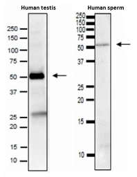 Anti-IZUMO1 antibody [#125] used in Western Blot (WB). GTX00689