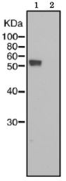 Anti-IZUMO1 antibody [#125] used in Western Blot (WB). GTX00689