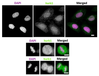 Anti-VRK1 antibody [5D1] used in Immunocytochemistry/ Immunofluorescence (ICC/IF). GTX00703