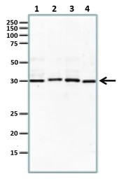 Anti-Rad51 antibody used in Western Blot (WB). GTX00720