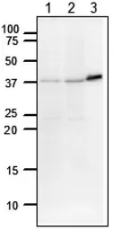 Anti-DNA polymerase beta antibody used in Western Blot (WB). GTX00722