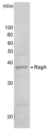 Anti-RRAGA antibody used in Western Blot (WB). GTX00730