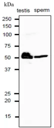 Anti-Calreticulin antibody used in Western Blot (WB). GTX00740