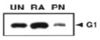 Anti-MAGEG1 antibody used in Western Blot (WB). GTX00755
