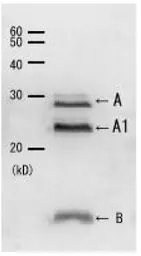 Anti-Cholera toxin antibody used in Western Blot (WB). GTX00756