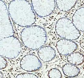 Anti-NLRP3 antibody used in IHC (Paraffin sections) (IHC-P). GTX00763