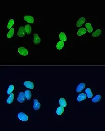 Anti-Lamin A + C antibody [GT1137] used in Immunocytochemistry/ Immunofluorescence (ICC/IF). GTX00774