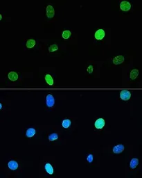 Anti-Lamin A + C antibody [GT1137] used in Immunocytochemistry/ Immunofluorescence (ICC/IF). GTX00774