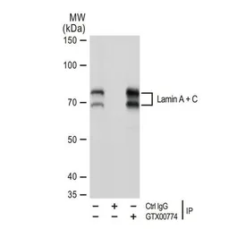 Anti-Lamin A + C antibody [GT1137] used in Immunoprecipitation (IP). GTX00774