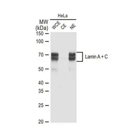 Anti-Lamin A + C antibody [GT1137] used in Western Blot (WB). GTX00774