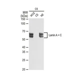 Anti-Lamin A + C antibody [GT1137] used in Western Blot (WB). GTX00774