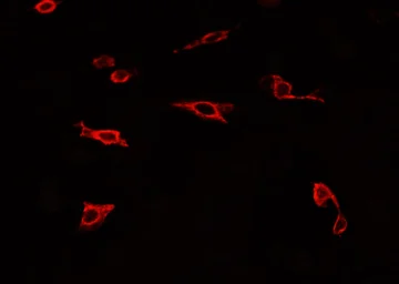 Anti-TLR4 antibody used in Immunocytochemistry/ Immunofluorescence (ICC/IF). GTX00783