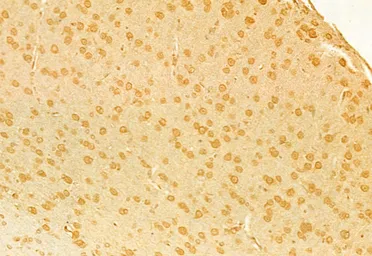 Anti-RUNX2 antibody used in IHC (Paraffin sections) (IHC-P). GTX00792