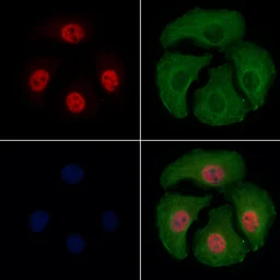 Anti-ATF2 (phospho Thr69) antibody used in Immunocytochemistry/ Immunofluorescence (ICC/IF). GTX00805