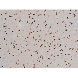 Anti-ATF2 (phospho Thr69) antibody used in IHC (Paraffin sections) (IHC-P). GTX00805