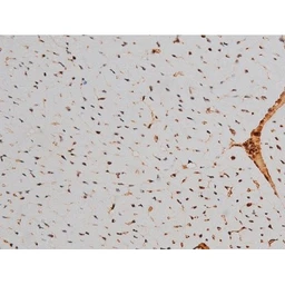 Anti-ATF2 (phospho Thr69) antibody used in IHC (Paraffin sections) (IHC-P). GTX00805