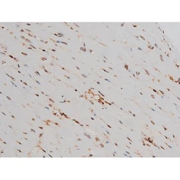 Anti-ATF2 (phospho Thr69) antibody used in IHC (Paraffin sections) (IHC-P). GTX00805