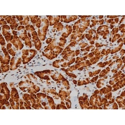 Anti-ATF2 (phospho Thr69) antibody used in IHC (Paraffin sections) (IHC-P). GTX00805