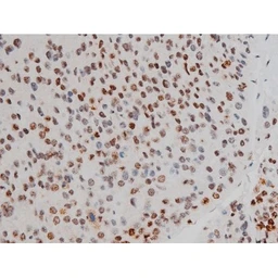 Anti-ATF2 (phospho Thr69) antibody used in IHC (Paraffin sections) (IHC-P). GTX00805
