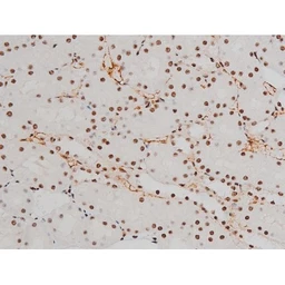 Anti-ATF2 (phospho Thr69) antibody used in IHC (Paraffin sections) (IHC-P). GTX00805