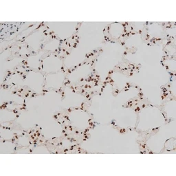 Anti-ATF2 (phospho Thr69) antibody used in IHC (Paraffin sections) (IHC-P). GTX00805