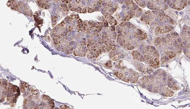 Anti-PACS2 antibody used in IHC (Paraffin sections) (IHC-P). GTX00808