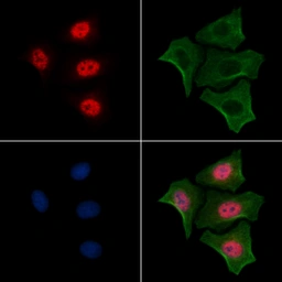 Anti-RUNX2 (phospho Ser28) antibody used in Immunocytochemistry/ Immunofluorescence (ICC/IF). GTX00811