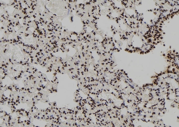 Anti-RUNX2 (phospho Ser28) antibody used in IHC (Paraffin sections) (IHC-P). GTX00811