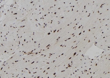 Anti-RUNX2 (phospho Ser28) antibody used in IHC (Paraffin sections) (IHC-P). GTX00811
