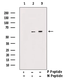 Anti-RUNX2 (phospho Ser28) antibody used in Western Blot (WB). GTX00811