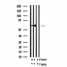 Anti-RUNX2 (phospho Ser28) antibody used in Western Blot (WB). GTX00811