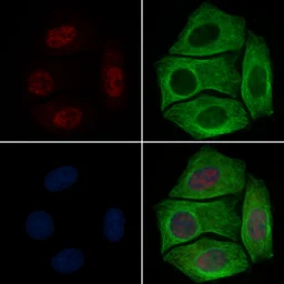 Anti-RUNX2 (phospho Ser340) antibody used in Immunocytochemistry/ Immunofluorescence (ICC/IF). GTX00812