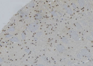 Anti-RUNX2 (phospho Ser275) antibody used in IHC (Paraffin sections) (IHC-P). GTX00813