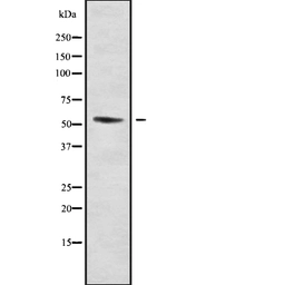 Anti-DMRTA1 antibody used in Western Blot (WB). GTX00815