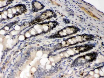 Anti-AIM2 antibody used in IHC (Paraffin sections) (IHC-P). GTX00830