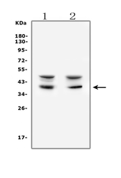 Anti-AIM2 antibody used in Western Blot (WB). GTX00830