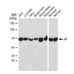 Anti-AIF antibody [GT1143] used in Western Blot (WB). GTX00833