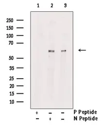 Anti-RIP3 (phospho Ser232) antibody used in Western Blot (WB). GTX00838