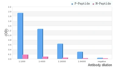 Anti-RIP3 (phospho Ser232) antibody used in ELISA (ELISA). GTX00838
