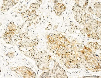 Anti-TGF beta Receptor I antibody used in IHC (Paraffin sections) (IHC-P). GTX00840