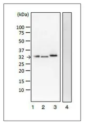 Anti-Verotoxin / Shiga toxin (SLT-1 + SLT-2) subunit A antibody [vero-01] used in Western Blot (WB). GTX00863